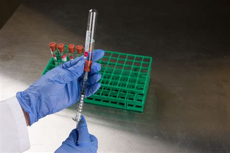 lab tests for botulism toxin
